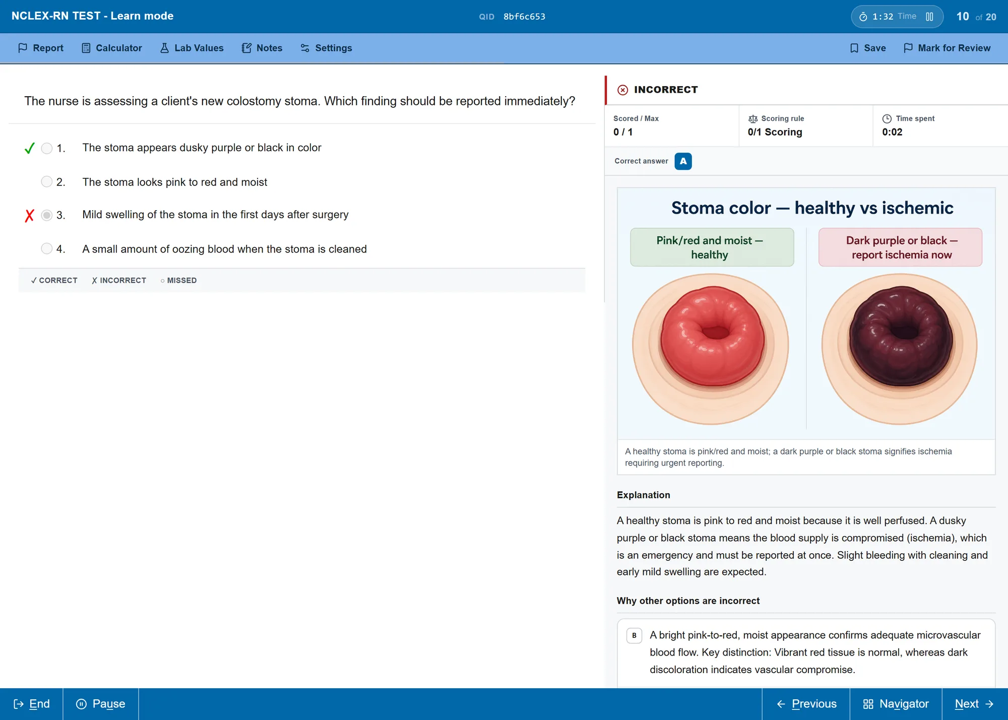 The exam-style player after a missed colostomy question, with the chosen option crossed and the correct one ticked, beside a figure comparing a healthy pink stoma with a dark purple ischemic stoma.